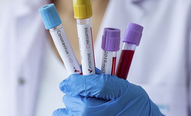 Koronavirüs Salgınına İlişkin Korkutan İlerleme!