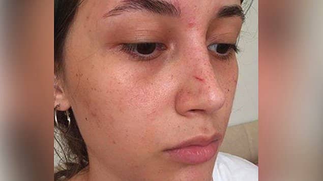 Şort Giydiği İçin Darp Edilen ODTÜ Öğrencisi Yaşadıklarını Anlattı