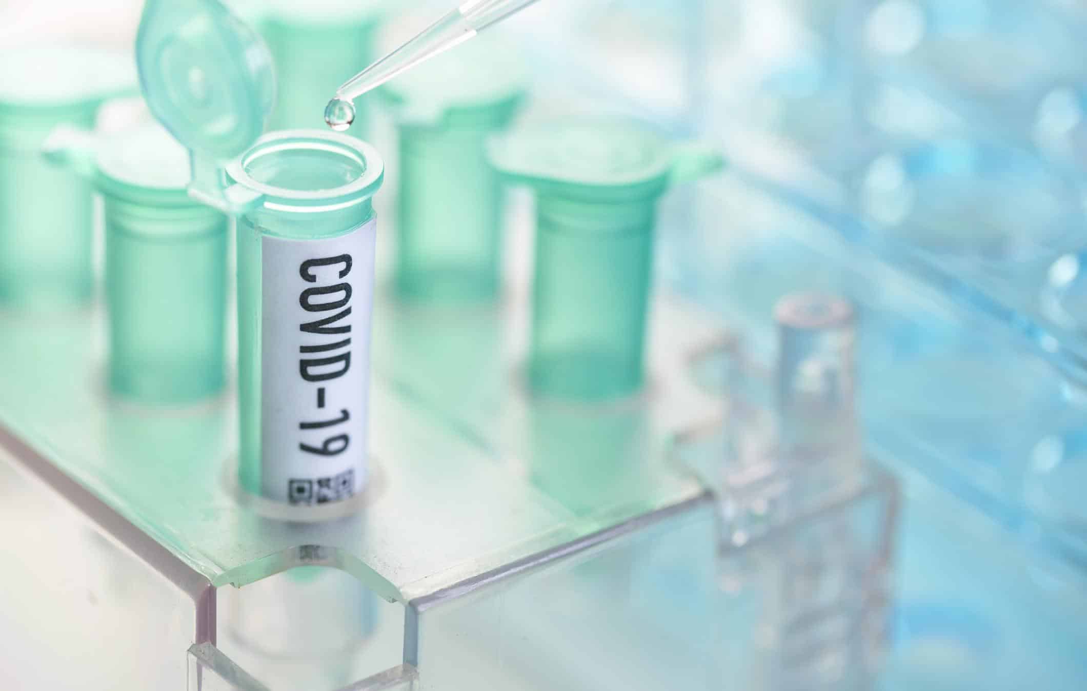 Koronavirüsü Belirtisiz Olarak Geçirdiğinizi Anlamanın Yolu