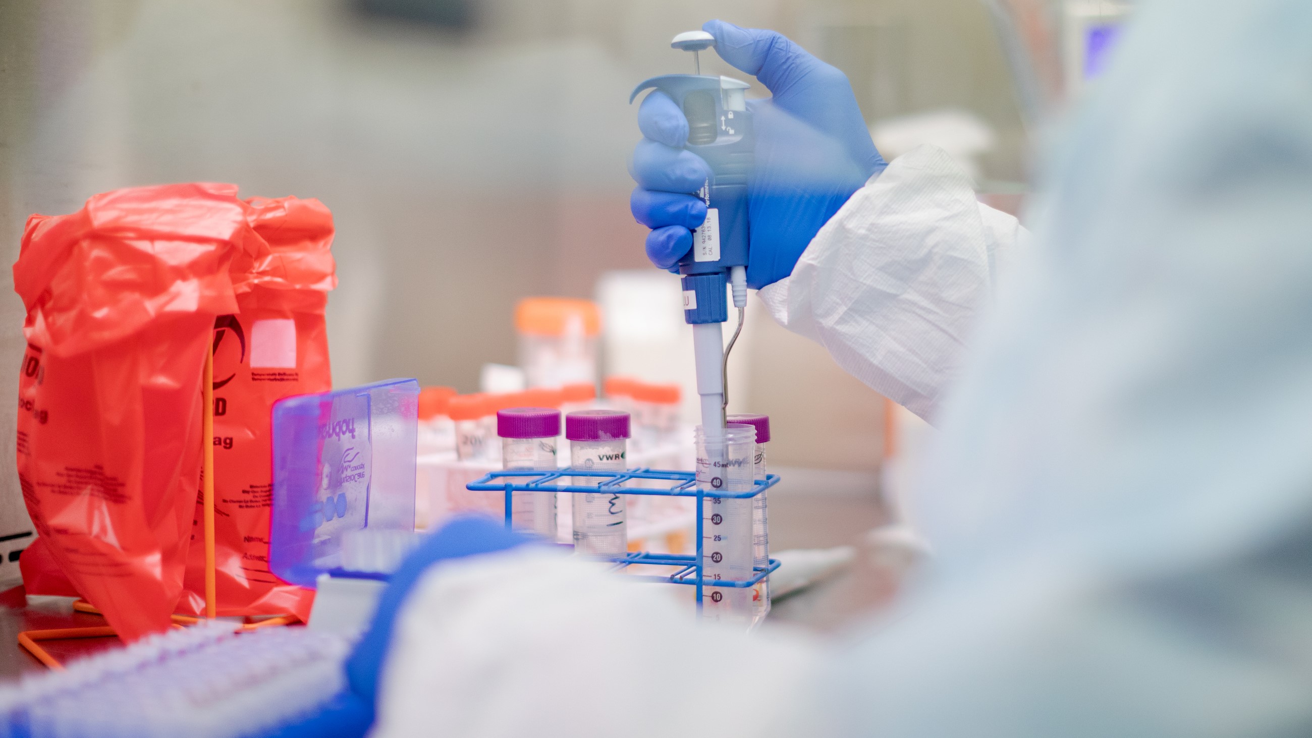 Son Dakika: Putin İlk Koronavirüs Aşısının Tescillendiğini Duyurdu