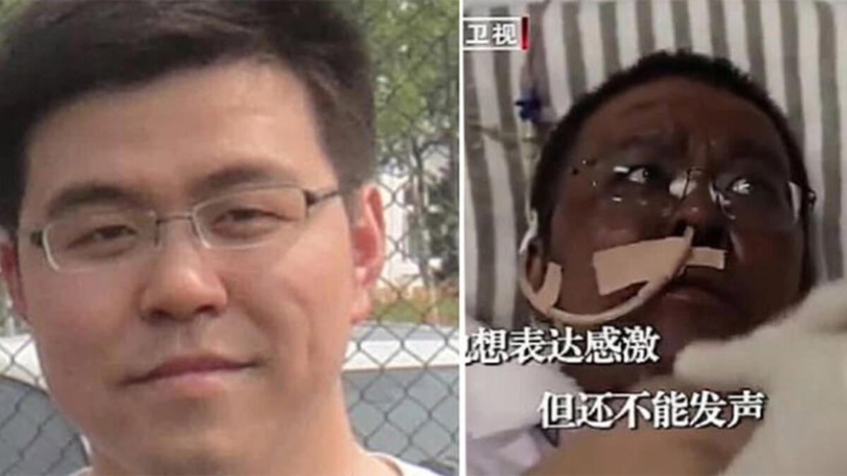 Koronavirüs Nedeniyle Rengi Değişen Doktor Eski Haline Döndü 