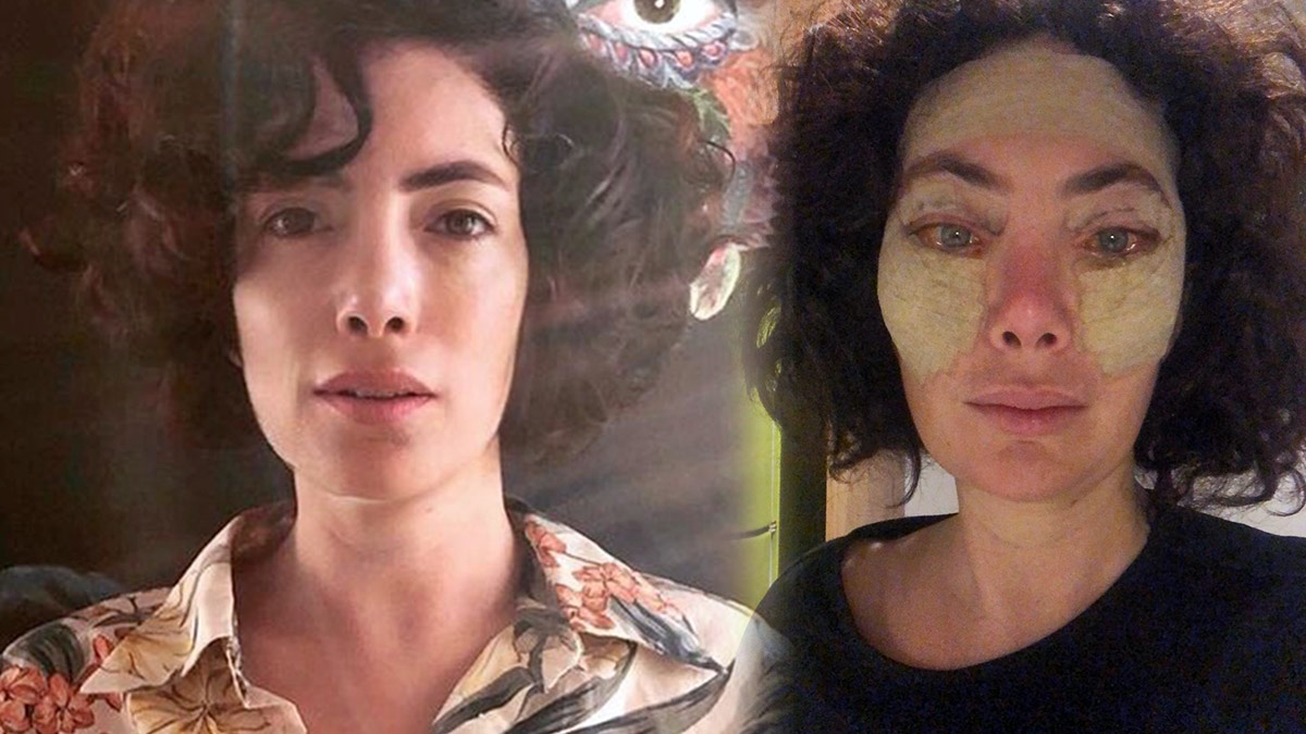 Akasya Asıltürkmen Estetik Pişmanlığını Takipçileri İle Paylaştı