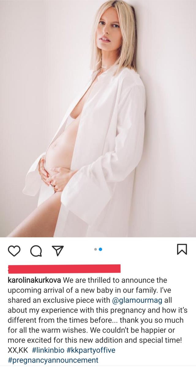 Ünlü Model Hamilelik Haberini Cesur Pozlarla Duyurdu!