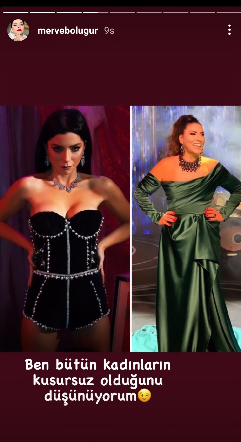 Gerilim Sürüyor! Işın Karaca Açtı Ağzını Yumdu Gözünü 