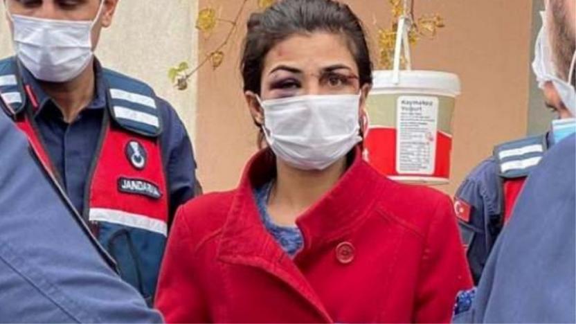 İşkence Gördüğü Eşini Öldüren Melek İpek'in İfadesi Kan Dondurdu!