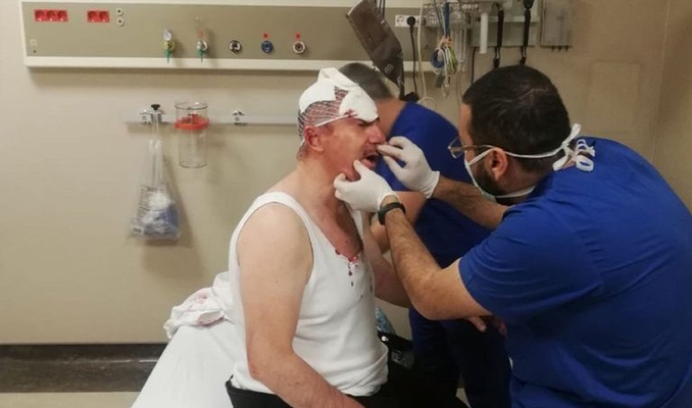 Gelecek Partili Selçuk Özdağ'a Saldırıda Bulunan 5 Kişi Tahliye Edildi! 