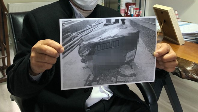 Kargo Şirketi Vatandaşın Dalağını Kaybetti!