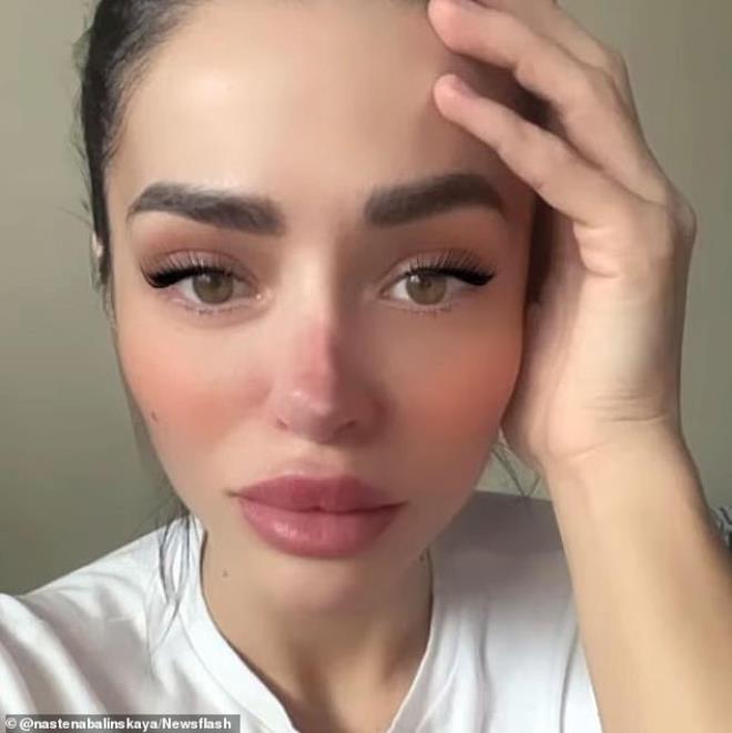 TV Yıldızı Estetik Kurbanı Oldu!