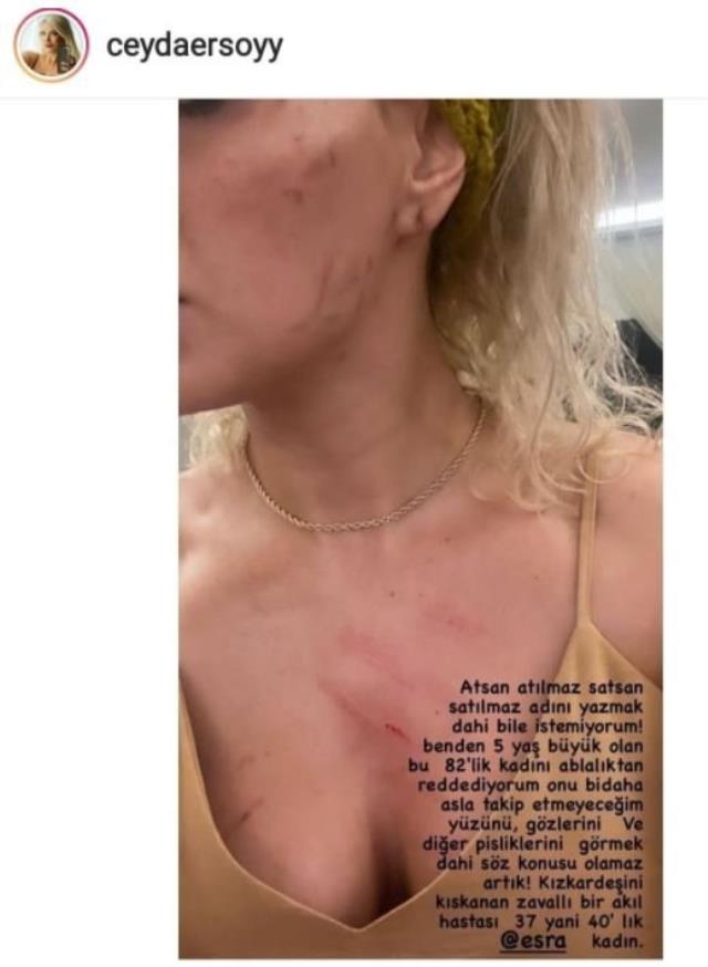 Esra ve Ceyda Ersoy Birbirine Girdi! Tartışma Kavgayla Sonlandı