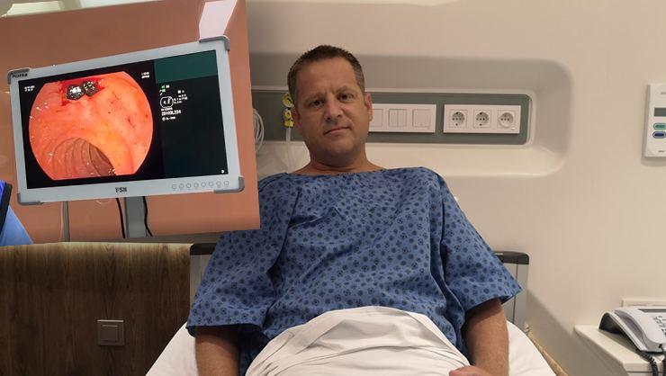 Safra Kanalından Tam 50 Tane Taş Çıktı!