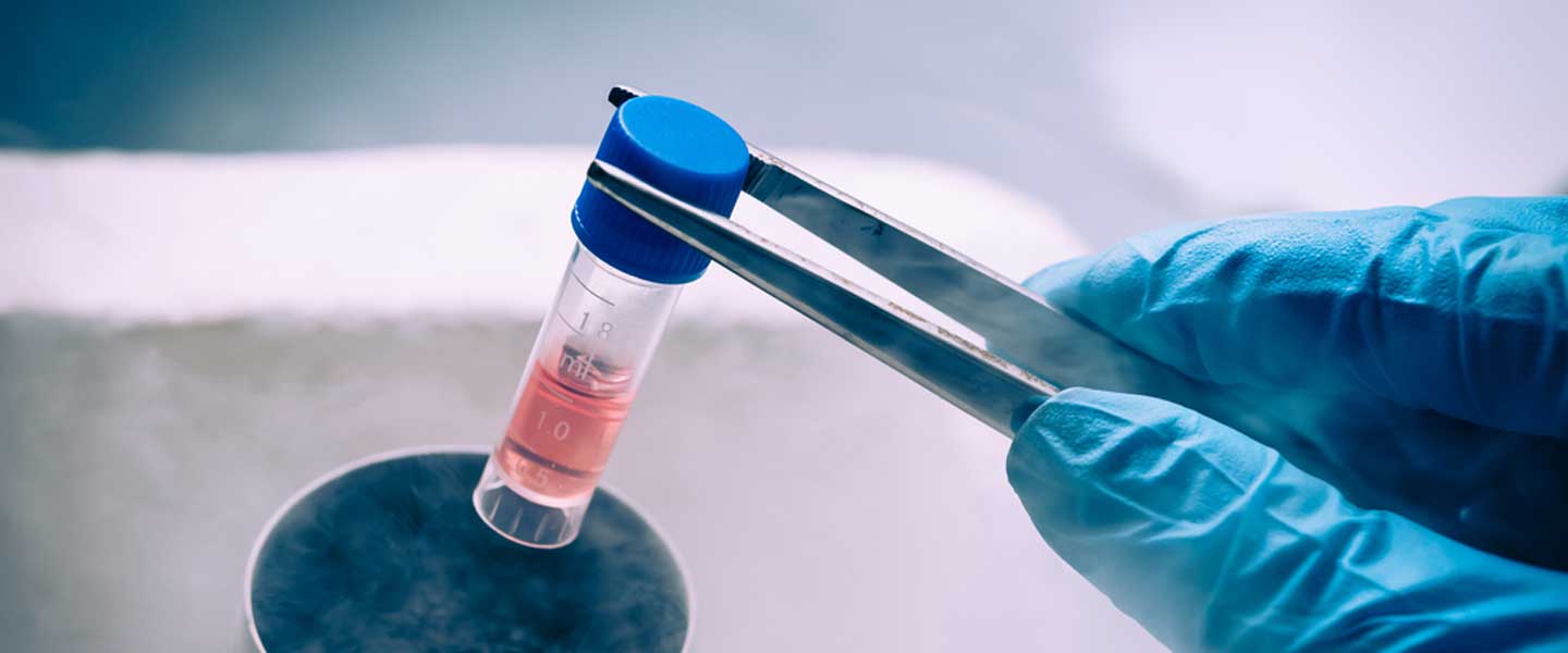 Kök Hücre Tedavisi Hakkında Tüm Bilinmeyenler