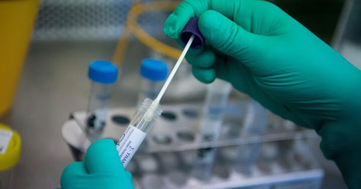 Dolandırıcılığın Böylesi! 300 TL'ye Negatif PCR Testi