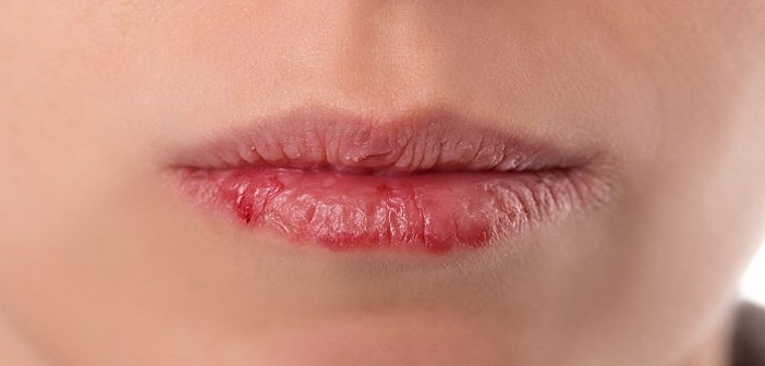 Uzman Ağız Kuruluğunun Nedenlerini Tek Tek Açıkladı!