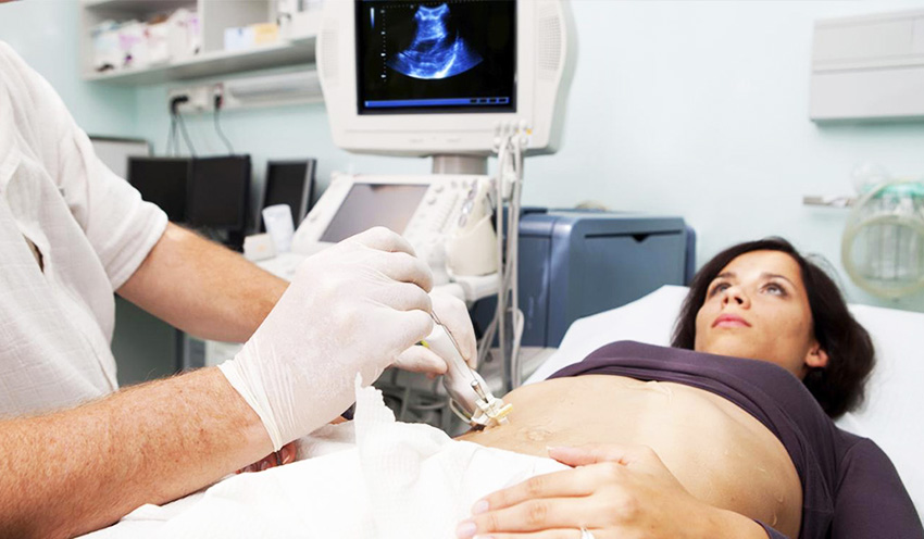 Dış Gebelik Nedir, Dış Gebelik Nasıl Anlaşılır?