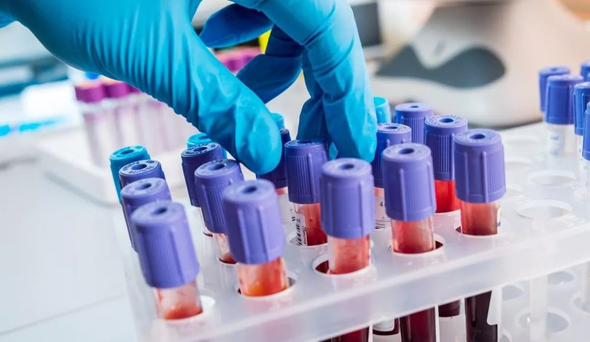 GGT Gama Glutamil Transferaz Nedir? GGT Yüksekliği ve Düşüklüğü Nedir?