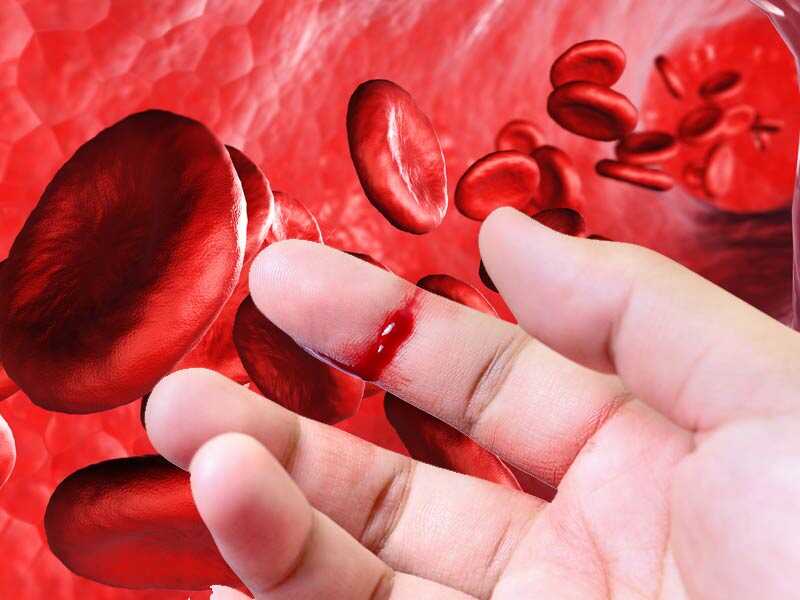 Hemofili Nedir? Hemofili Neden Olur?