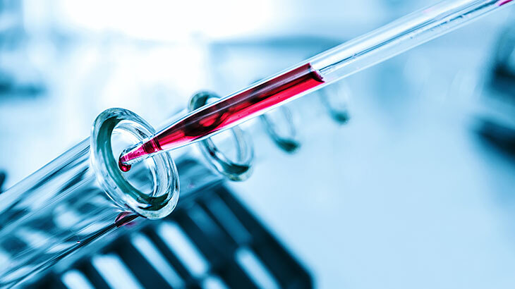 MPV Nedir? Yüksekliği Ve Düşüklüğü Ne Anlama Gelir?