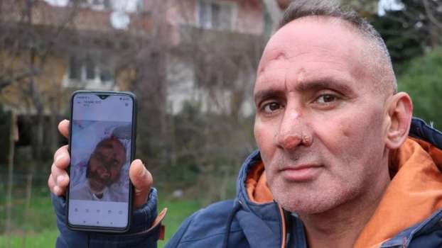 Sinek Isırığı Kabusu Oldu!