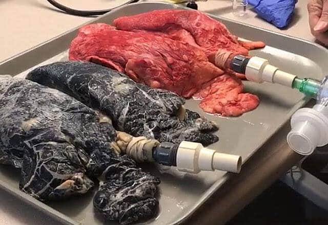 Sigara Bıraktığımızda Akciğer Kendini Yeniliyor!