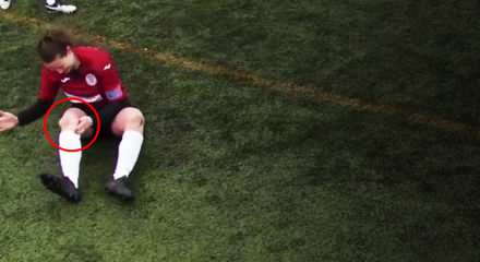 Kadın Futbolcu Çıkan Diz Kapağını Vurarak Yerine Oturttu!