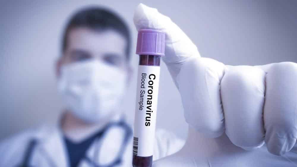 Azerbaycan'da Koronavirüs’ten İlk Ölüm Haberi Geldi