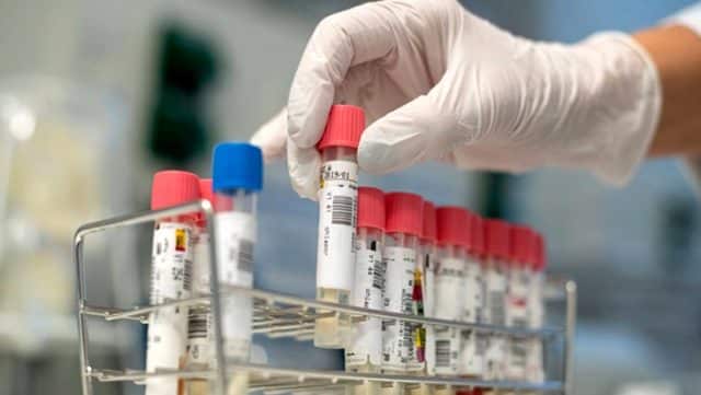 49 Gün Vücutta Duran Koronavirüs Tespit Edildi!