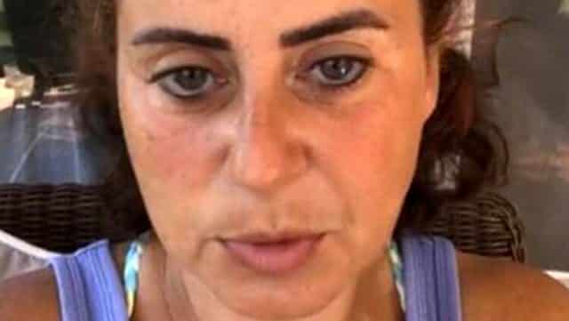 Aynı Maskeyi Birçok Kez Kullanan Ünlü İsim Hastalığa Yakalandı