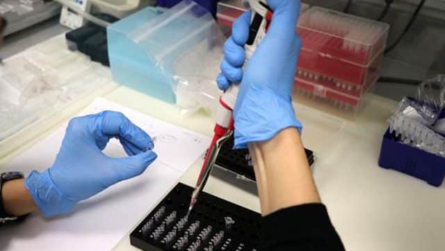 Koronavirüse Yakalanma Kapsamında Kan Grupları Farklı Oranda Etkileniyor