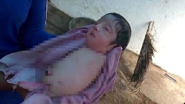 Hindistan'da Doğan Bir Bebek Herkesi Hayrete Düşürdü!
