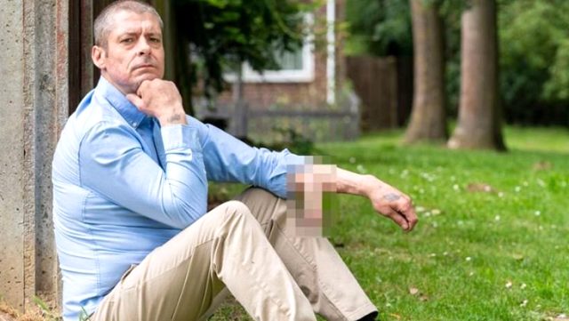 4 Yıldır Kolunda Bir Cinsel Organla Yaşıyor!