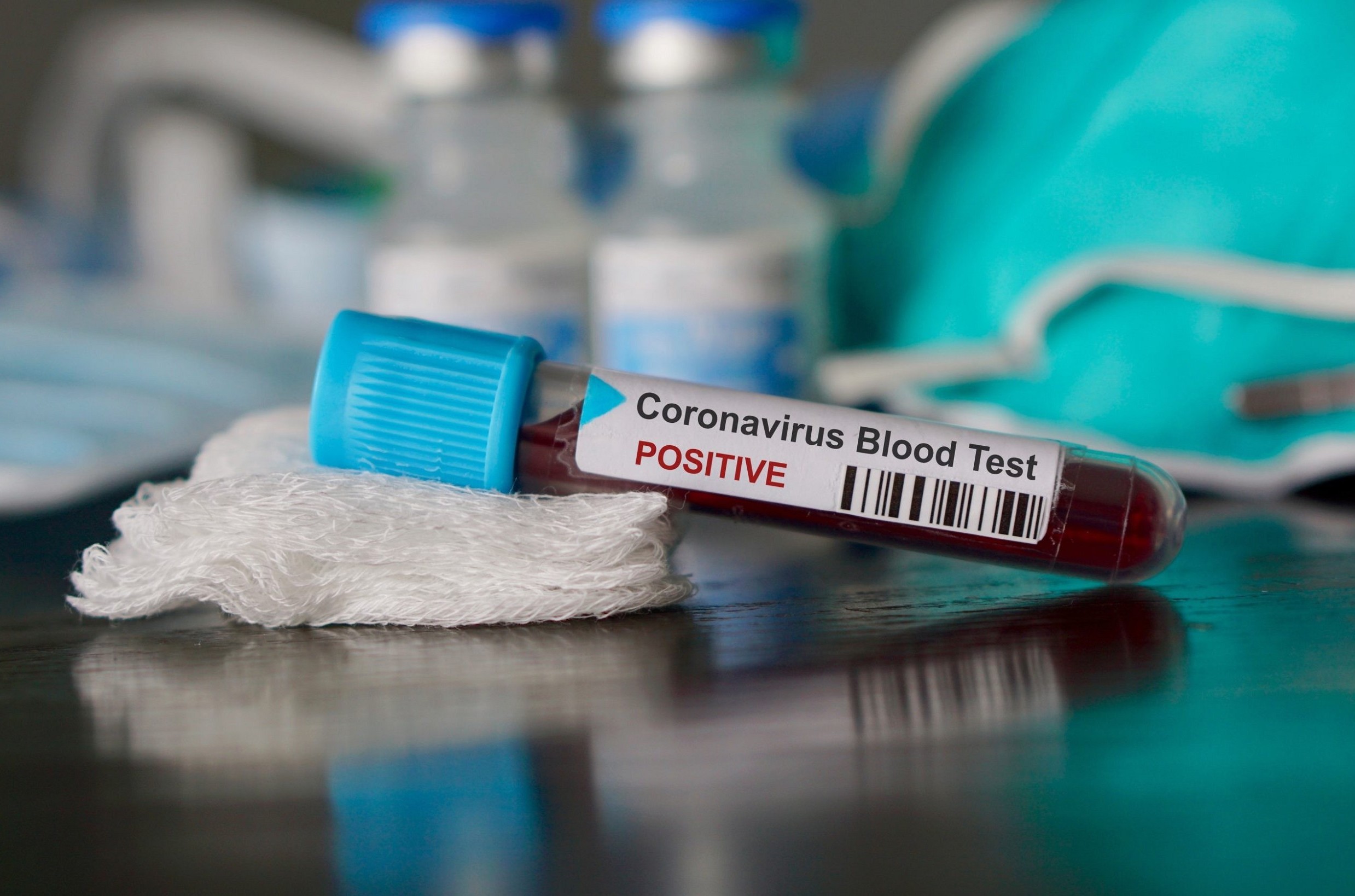 Araştırmalar 6 Farklı Koronavirüs Hastası Olduğunu Gösteriyor