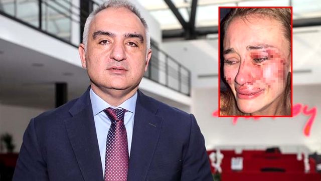 Çeşme'de Şiddet Gören Kadın İçin Kültür ve Turizm Bakanından Açıklama