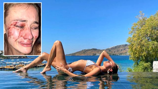 Çeşme'de Bir Modelin Şiddet Görmesine İlişkin Çeşme Kaymakamının Görev Yeri Değişti