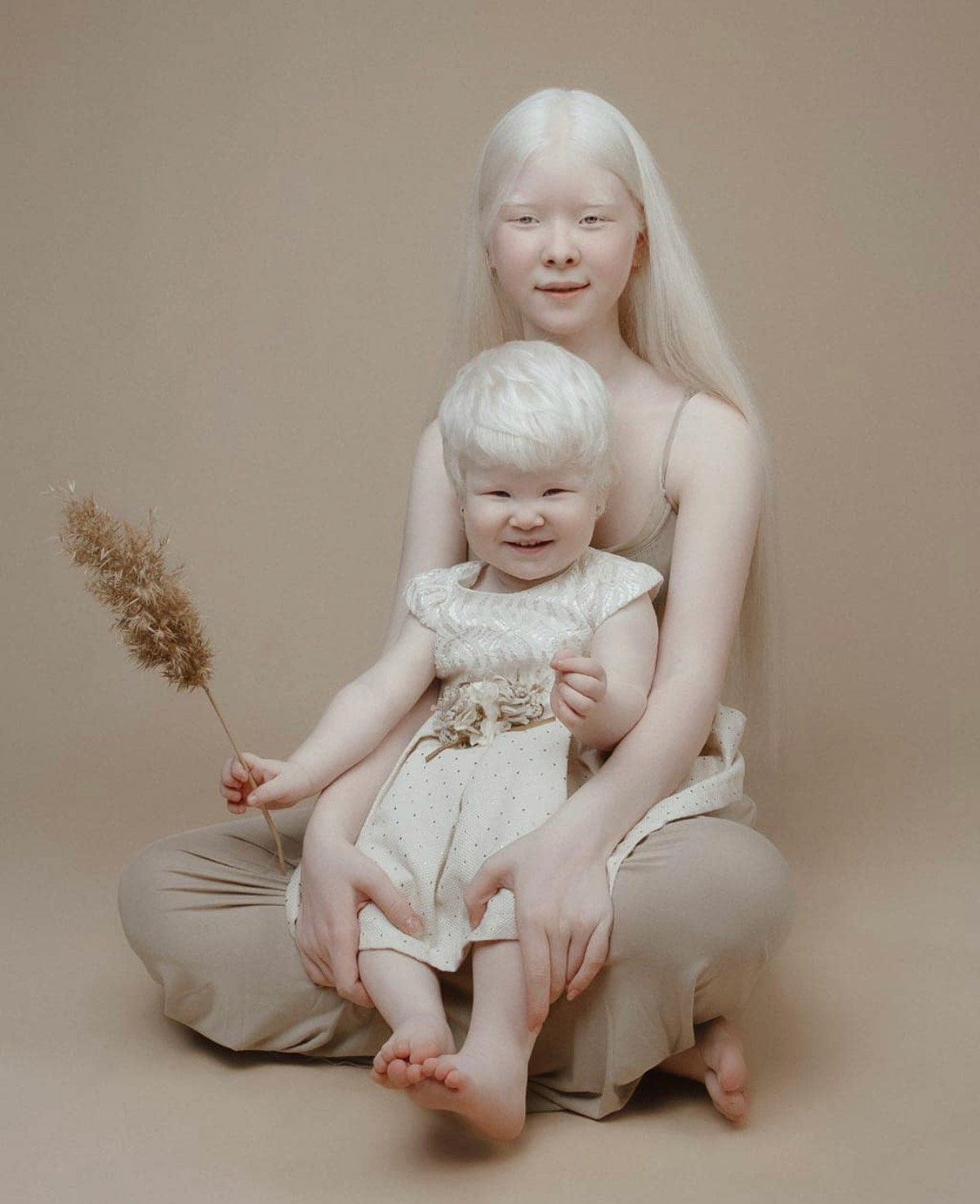 Albino Nedir? Albinizm Belirtileri Nelerdir?