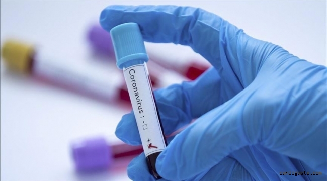 30 Haziran Koronavirüs Tablosu Açıklandı! 45 Kişi Yaşamını Yitirdi