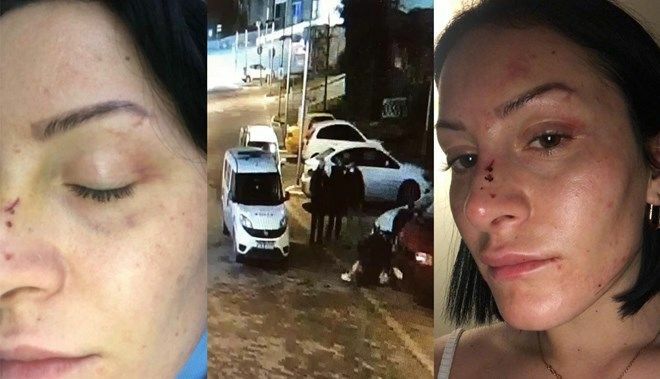Genç Kadın Önce Polis Ardından da Doktor Tarafından Şiddete Uğradı