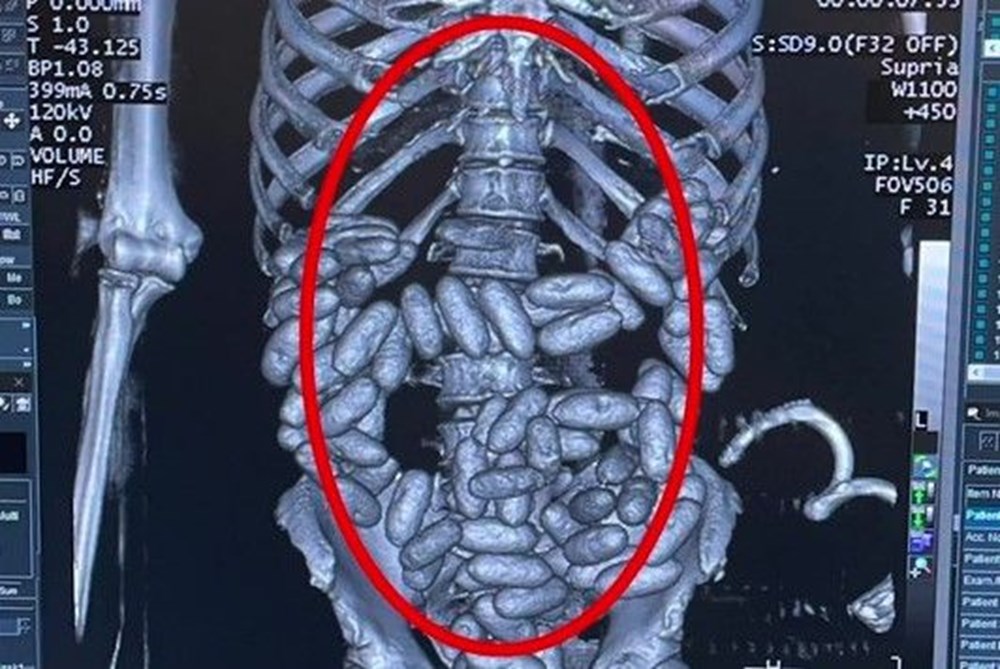 Uyuşturucu Kaçakçısı İstanbul Havalimanı’nda Yakalandı