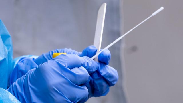PCR Testlerinde Varyant Endişesi