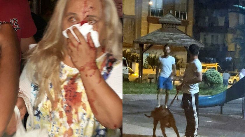 Sahibinin Saldığı Pitbull, Parkta Dolaşan Kadını Burnundan Isırdı