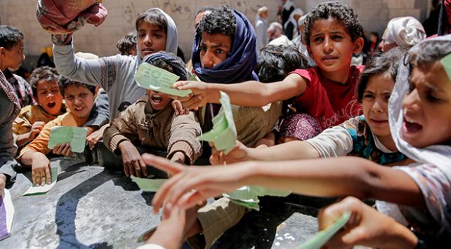 Yemen’de Yaklaşık 400 Bin Çocuk Yetersiz Beslenme Nedeniyle Ölüm Riski Taşıyor