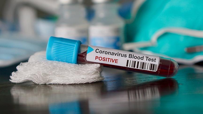 3 Eylül Koronavirüs Tablosu Açıklandı! 276 Kişi Yaşamını Yitirdi