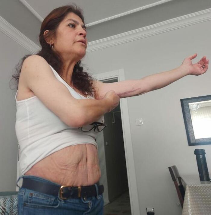 İngiltere’den Türkiye’ye Ameliyat Olmak İçin Gelen Selda Gümüş Pişman Oldu