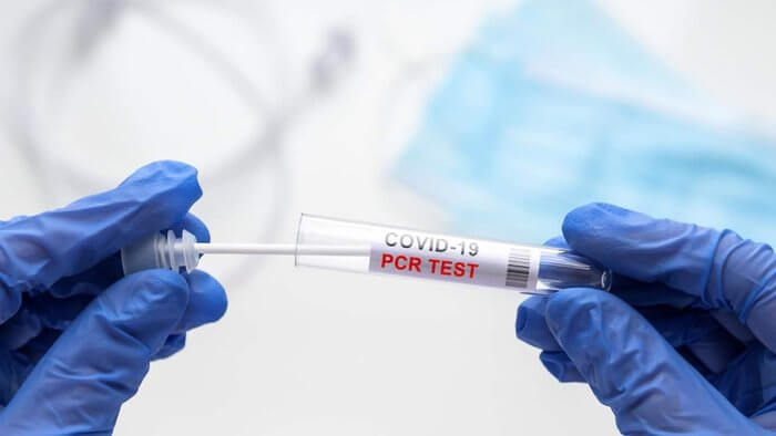 Aşı Olmayan Kişilere Uygulanan PCR Testi Zorunluluğu Kaldırıldı