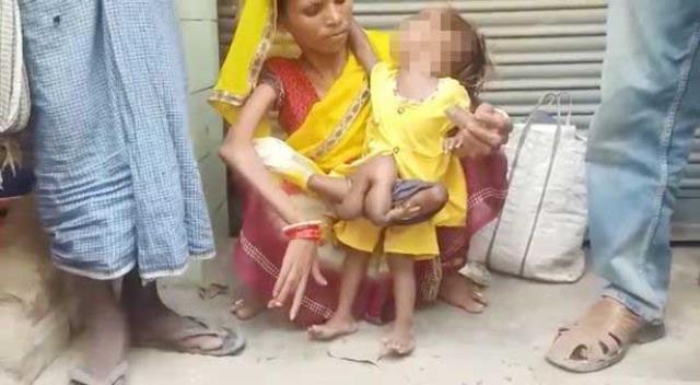 Doktorlar Şokta: Hindistan’da Bebek 6 Bacaklı Doğdu