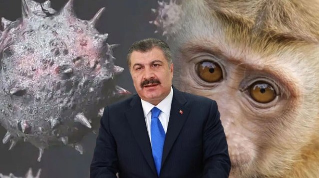 Maymun Çiçeği Türkiye'de Görüldü mü? Kaç Kişide Görüldü, Nasıl Bulaşır?