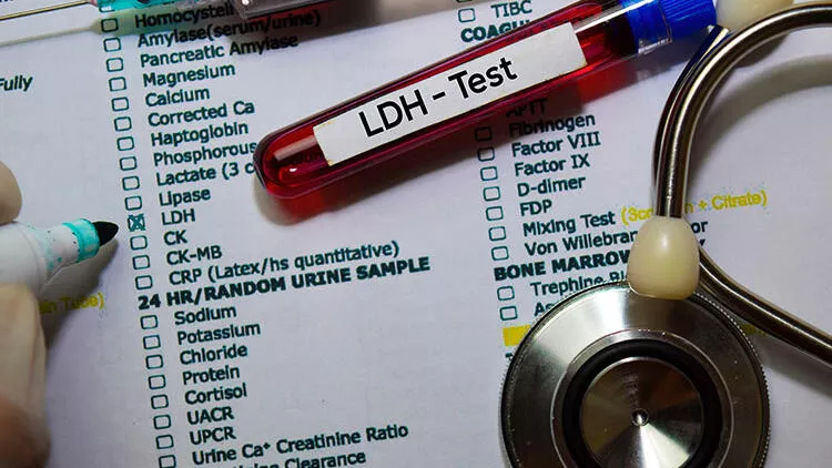 LDH Laktat Dehidrogenaz Nedir? Laktat Dehidrogenaz Yüksekliği ve Düşüklüğü Nedir?
