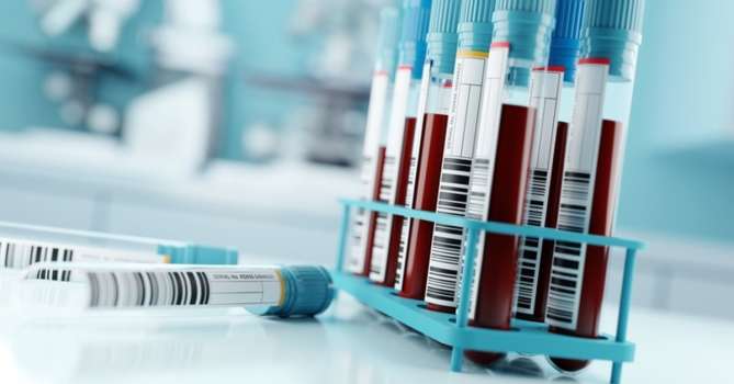 Alkalen Fosfataz Nedir, Alkalen Fosfataz Değerleri Kaç Olmalı?