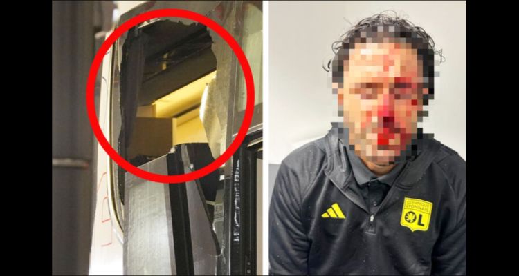 Marsilya-Lyon Maçı Neden Ertelendi! Otobüs Taşlandı Teknik Direktör Kanlar İçinde Kaldı