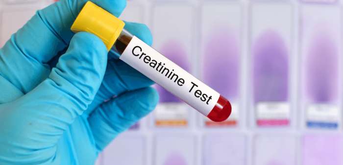 Kreatinin Nedir? Kreatinin Yüksekliği Ve Düşüklüğü Neden Olur?