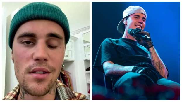 Justin Bieber Yüz Felci Oldu, Tüm Konserleri İptal Edildi!